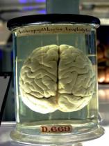 brain in a jar